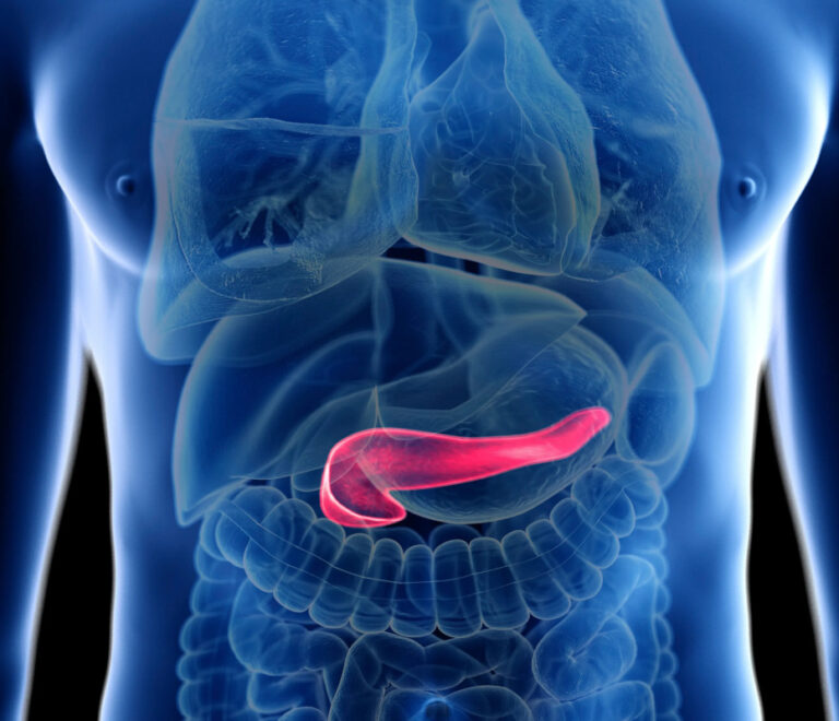 Tumore al pancreas